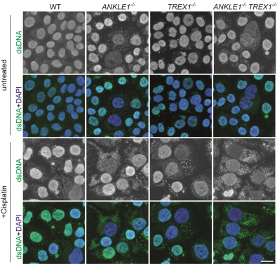 Knockout of ANKLE1 induces excessive accumulation of cytosolic DNA, leading to activation of immune responses. (Image credit: Dr Gary Ying Wai CHAN and Dr Huadong JIANG)